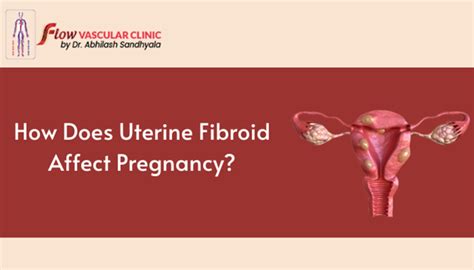 How Does Uterine Fibroids Affect Pregnancy Dr Abhilash