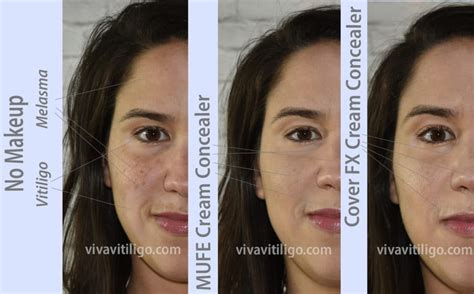 Makeup Forever Full Cover Concealer Before And After Mugeek Vidalondon