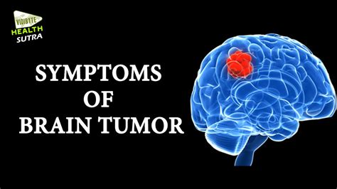 Symptoms Of Brain Tumor Youtube
