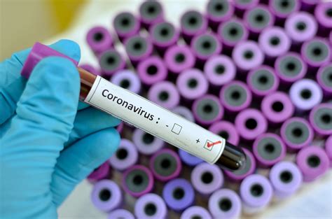 Severe cardiac involvement may be present, with eosinophilic myocarditis. CDC Develops ICD-10 Code for 2019 Novel Coronavirus (COVID-19)