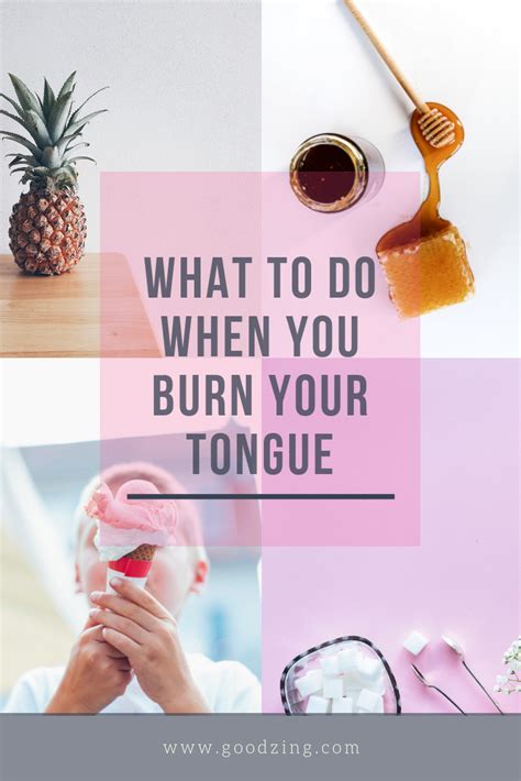 Ouch We All Know How Uncomfortable A Burnt Tongue Is But Do You Know