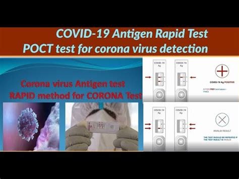 COVID-19 antigen rapid test | POCT test for corona virus ...