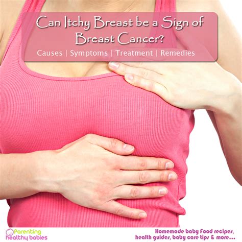 Itchy Breast Cancer