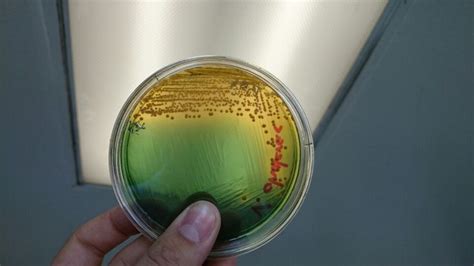 Colonias De Vibrio Cholerae En Medio Tcbs