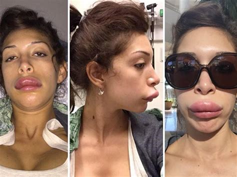 Farrah Abrahams Before And After Plastic Surgery Overall Appearance Looked So Different