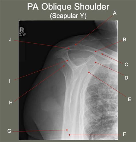 Shoulder Scapular Y PA Oblique Diagram Quizlet