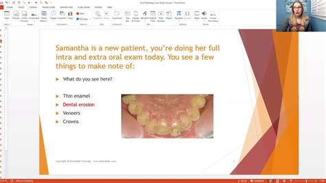 Oral Pathology Case Study Session Youtube