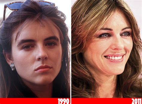 Chatter Busy Elizabeth Hurley Plastic Surgery