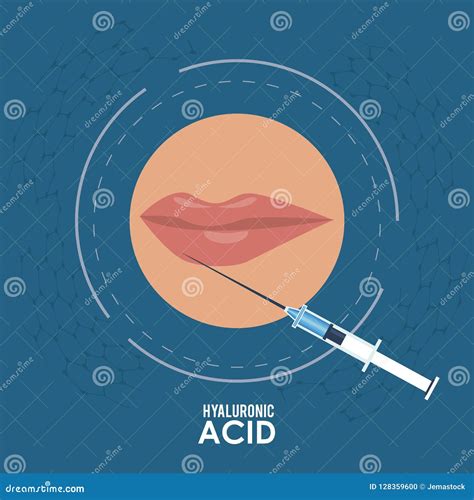 Hyaluronic Acid Filler Injection Infographic Flyer Vector Illustration