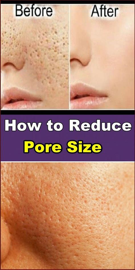 How To Reduce Pore Size Skin Name Tips Rambut