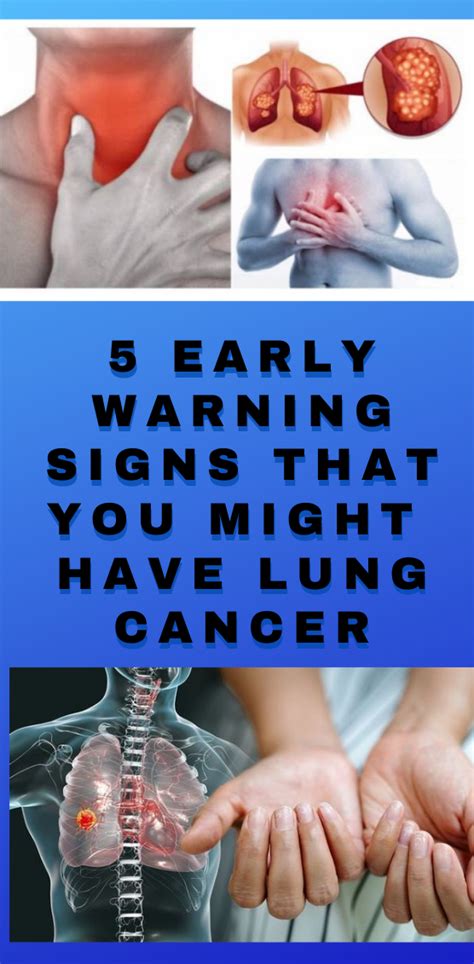 Early Warning Signs That You Might Have Lung Cancer Wellness Days