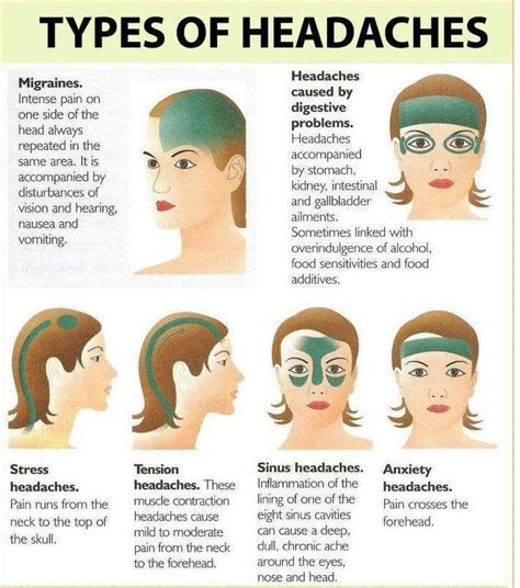 Chart Of Types Of Headaches