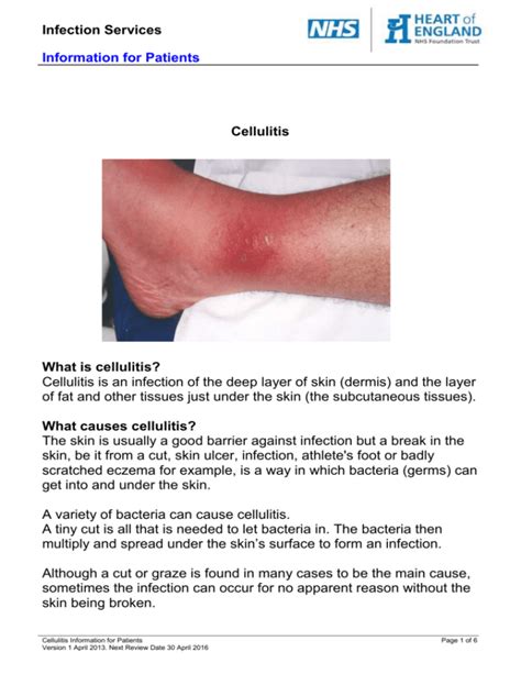 Cellulitis Leaflet Intravenous Therapy At Home