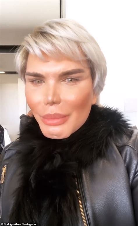 human ken doll exclusive rodrigo alves reveals he s in agony after chin