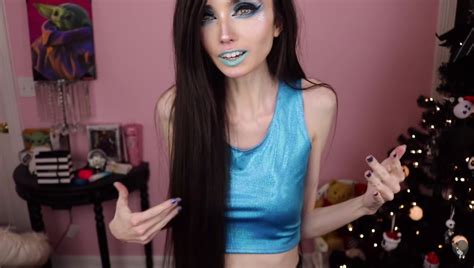 Anorexic Youtuber Eugenia Cooney Sparks Serious Health Concerns From Her Followers Page