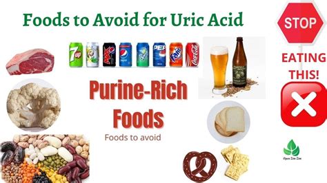 Stop Eating This Foods To Avoid For Uric Acid Gout Natural Cure Youtube