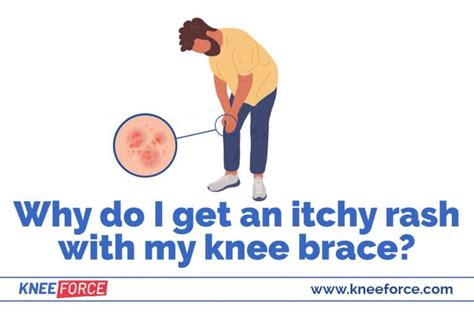Itchy Rash From A Knee Brace › Knee Force