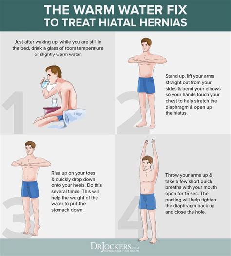 Hiatal Hernia Symptoms Causes And Natural Support Strategies Hernia Exercises Hiatus Hernia