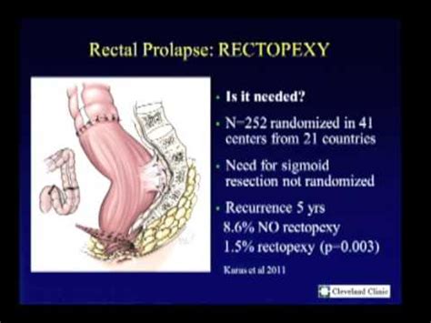 Surgical Management Of Recurrent Rectal Prolapse Youtube