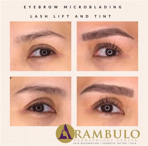 Eyebrow microblading philippines at the medical city