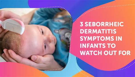 3 Seborrheic Dermatitis Symptoms In Infants To Watch Out For