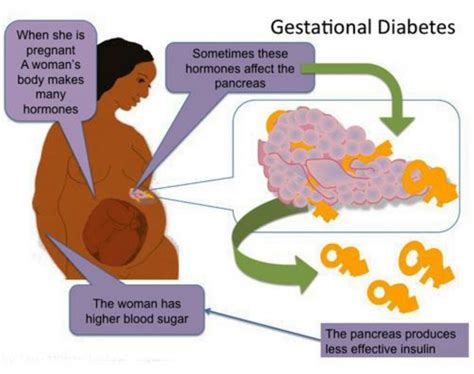 Your doctor will check for it between weeks 24 and 28, or sooner if you're at high risk. Gestational Diabetes - DANII Foundation