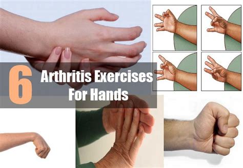 Arthritis Exercises For Hands Arthritis Exercises Arthritis Arthritis Treatment