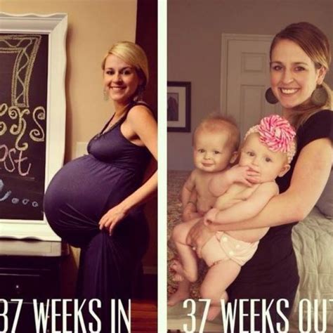 11 Pregnancy Before And After Photos That Will Make You Gasp First