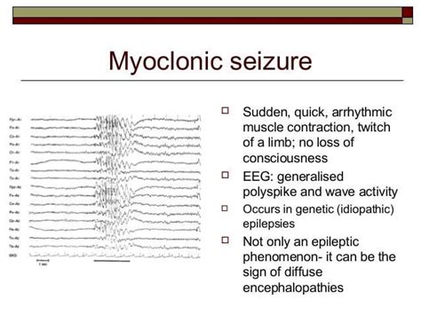 Myoclonic Seizures With Grunting Angelman Syndrome Adult Acne Symptoms