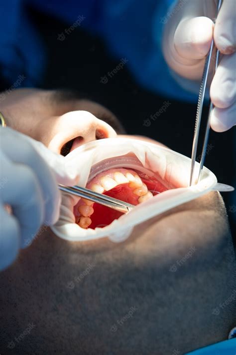 Free Photo Pacient In Dental Clinic While Operation