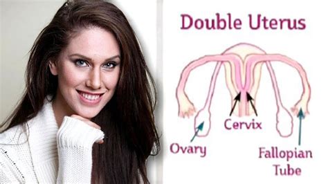 Woman Born With Two Vaginas Reveals What Its Really All About Daily