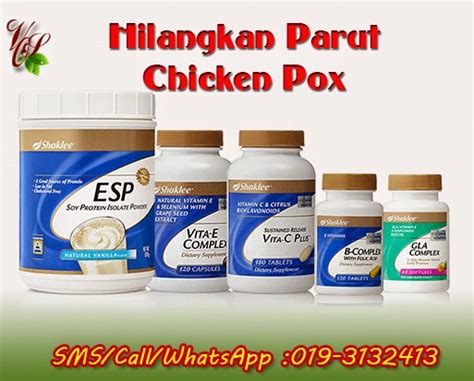 Read more about chickenpox symptoms and when to get medical advice. Cara Hilangkan Parut Chicken Pox Agar Muka Cantik Berseri ...