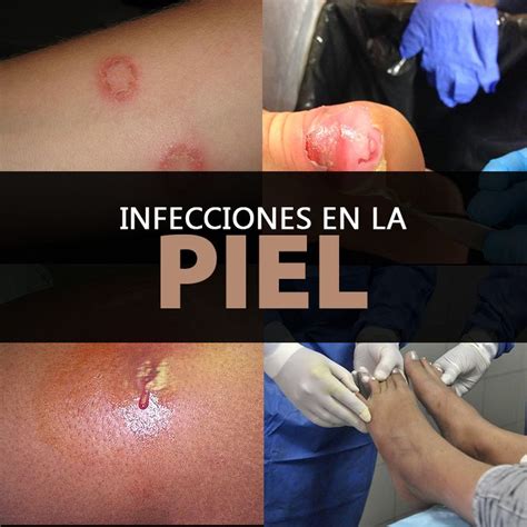Álbumes Foto Fotos De Infecciones En La Piel Mirada Tensa