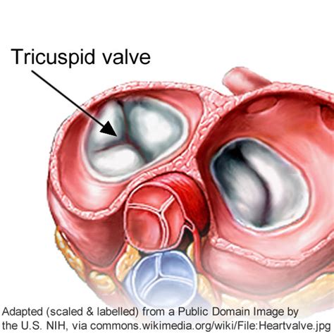Anatomy Of Bicuspid Aortic Valve