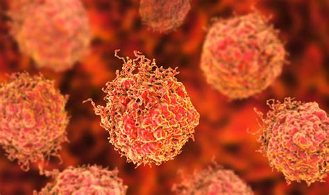 Need to get up many times during the night to pass urine growing older raises your risk of prostate problems. Prostate cancer signs and symptoms: Six factors that can ...