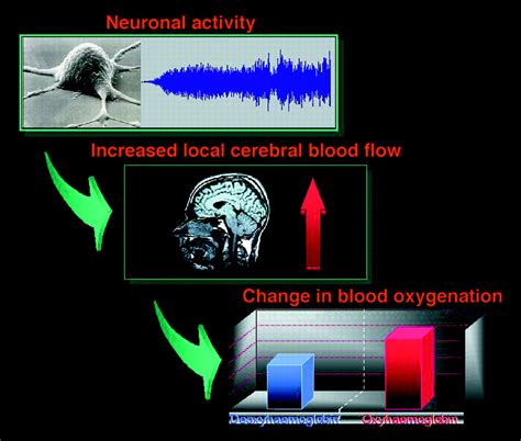 Functional Magnetic Resonance Imaging In Neuropsychiatry The Bmj