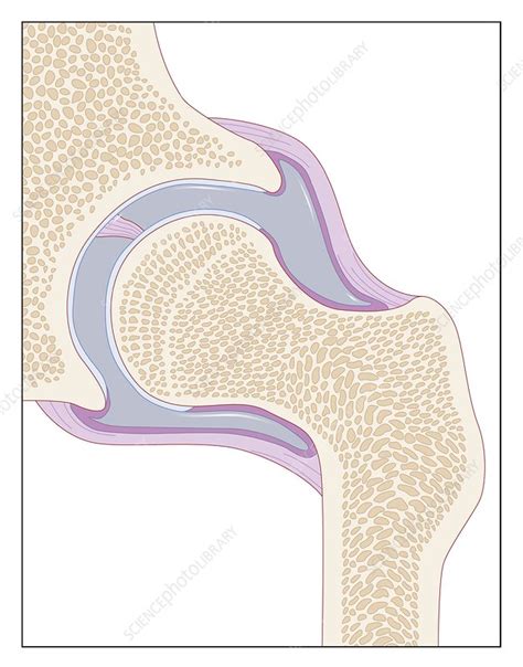 Hip Joint Artwork Stock Image C008 3738 Science Photo Library