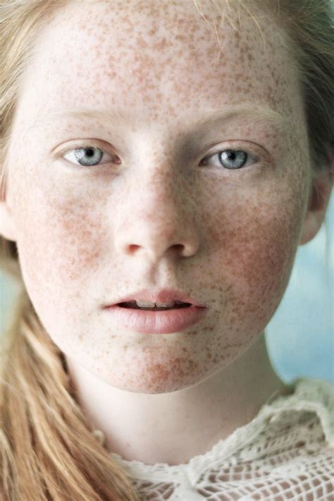 Portraits By Carla Pires Beautiful Freckles Freckles Girl Red Hair