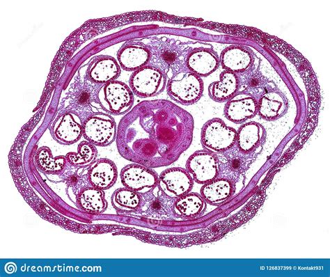 Microscopic Cross Section Cut Of A Plant Stem Under The