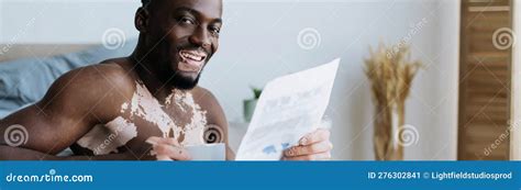 Smiling African American Man With Vitiligo Stock Image Image Of