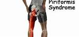 Isotonic Muscle Strengthening Knee Pictures