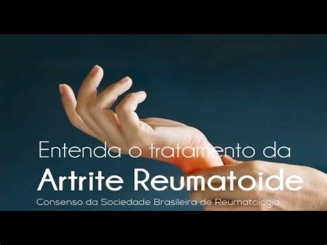 Entenda O Tratamento Da Artrite Reumatoide YouTube