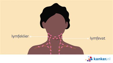 Operatie Aan De Lymfeklieren Bij Neuskanker Kankernl
