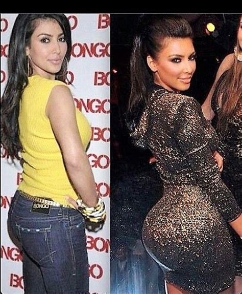 kim kardashian butt implants before and after pics 3 kim kardashian surgery kim kardashian hips