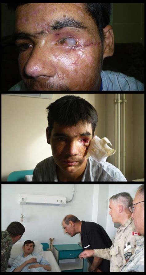 By the communist people's democratic party of afghanistan. Kedhaifan Hospital Dawood Di Afghanistan (14 Gambar)