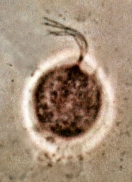 Filetrichomonas Vaginalis Phase Contrast Microscopy Wikimedia