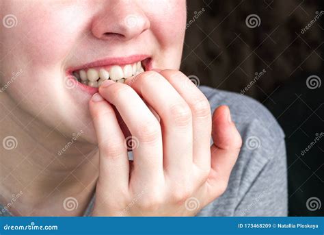 Female Biting Her Nails Stock Image Image Of Lips 173468209