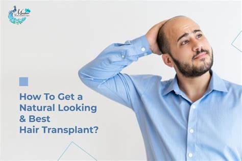 Want Natural Looking Hair Transplant Visit The Best Hair Transplant Clinic