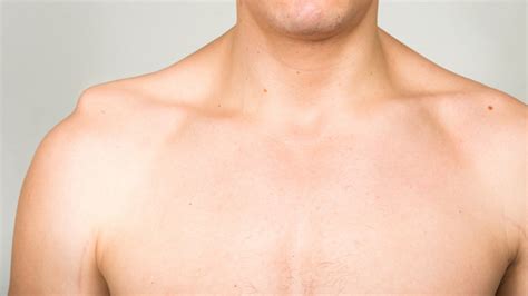 How long will it take for my shoulder to heal? Separated Shoulder: Symptoms, Treatment and Recovery Time ...