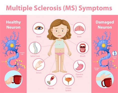 Free Vector Multiple Sclerosis Ms Symptoms Information Infographic